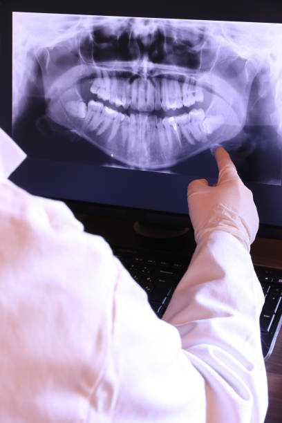 Best Emergency Root Canal Treatment in Lake Monticello, VA