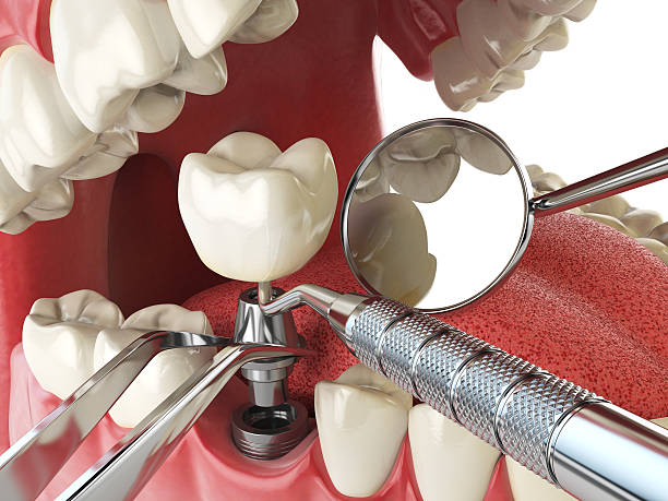 Best Mobile Emergency Dentist in Lake Monticello, VA